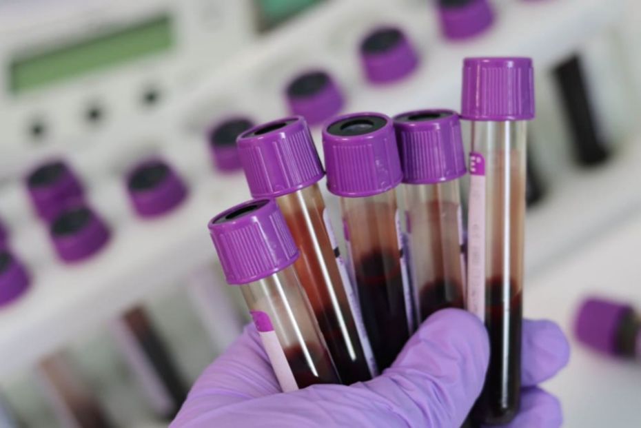 Bornholm har relativt mange smittede