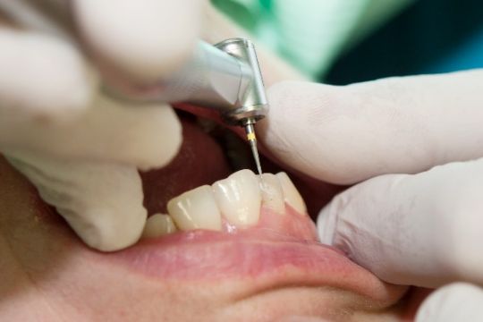 Covid-19 koster tandtekniker dyrt