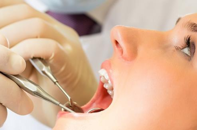 Tandplejen holder lukket i påsken