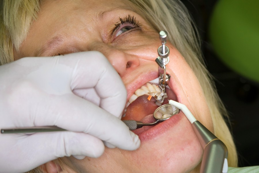 Mindre overskud hos tandl�ge