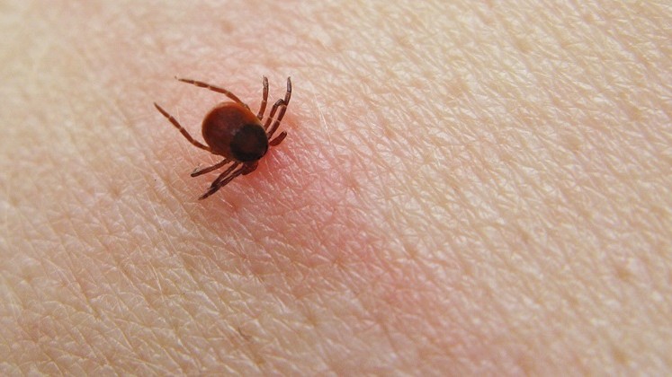 SSI fastholder anbefalinger om TBE-vaccination p� Bornholm